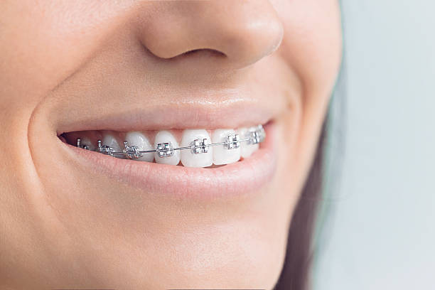 Best Teeth Whitening  in Haltom City, TX